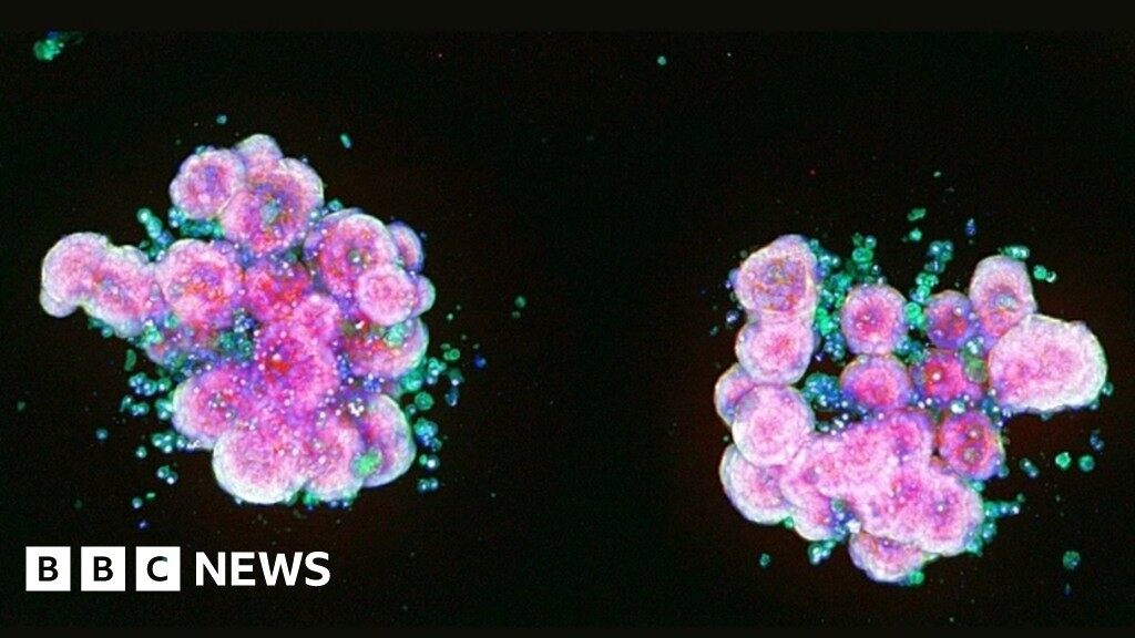 Plans for £20m hub in Cambridge to develop new medicines using AI